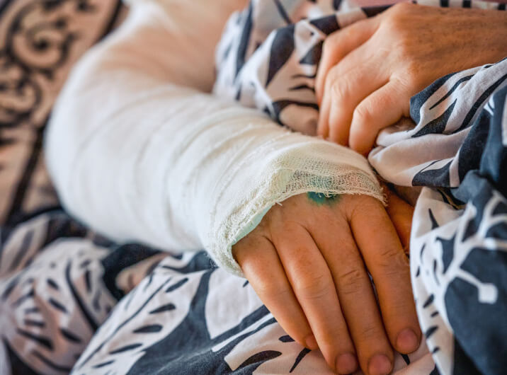 Person mit gebrochenem Arm im Bett